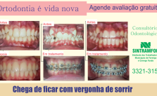 hortodontia_bitmep